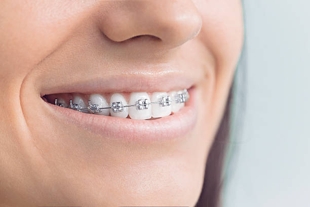 Best Veneers and Lumineers  in Surfside, FL